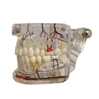 1 бр. Обучение модел на зъбен нерв, Ясна Образователна демонстрационен модел за ремонт на стоматологични инструмент
